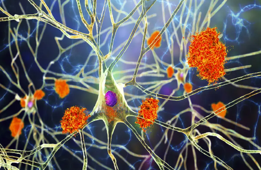 “النبات المعجزة”.. مفتاح جديد لعلاج ألزهايمر